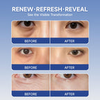 4 pairs PDRN & Calcium Micro Eye Patches, Under Eye Patches for Puffy eyes, Dark Circles & Wrinkle | Hyaluronic Acid, Kojic Acid, Collagen, Peptides, Vitamin C, Niacinamide - Korean Popular Eye Care