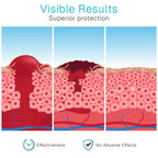ViveCare Hydrogel Wound Dressing (3 Oz Tube) - First Aid Healing Gel
