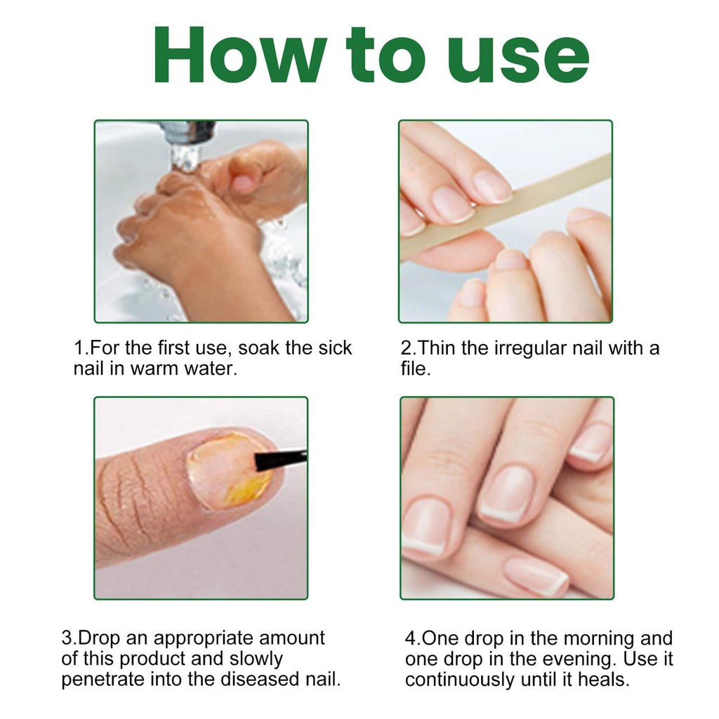 Ginger Toenail Fungus Treatment, Fungal Nail Treatment, Ginger Nail Growth Serum,7 Days Nail Treatment, Antifungal Nail Repair Serum, Fast-Acting Recovery for Thick, Discolored, Yellow Nails