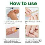 Ginger Toenail Fungus Treatment, Fungal Nail Treatment, Ginger Nail Growth Serum,7 Days Nail Treatment, Antifungal Nail Repair Serum, Fast-Acting Recovery for Thick, Discolored, Yellow Nails