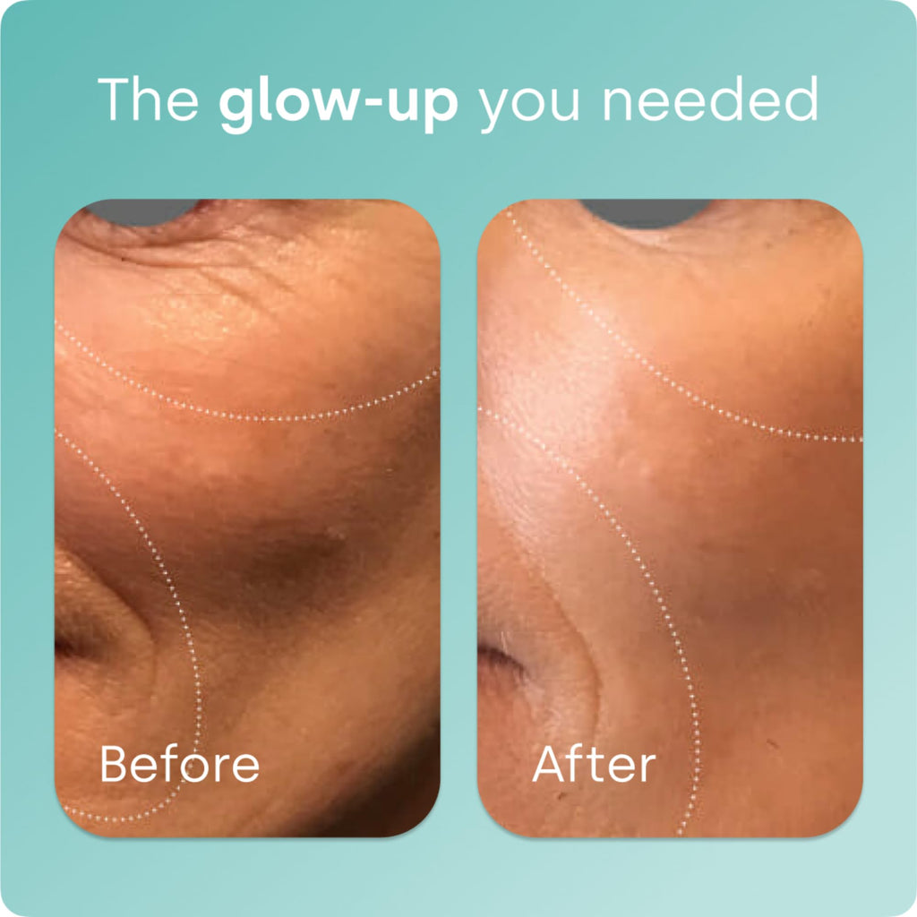 Biosil Collagen Booster Supplement - 60 Original Capsules - Patented ch-OSA Activator for Skin, Hair, Nails & Joints - Supports Natural Production - 30-Day Supply