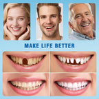 Moldable False Teeth - Silicone Dentures - Men and Veneers Teeth for Women - Upper and Lower Matching Set - Fix Your Smile at Within Minutes - Blue - 1PCS - Y7