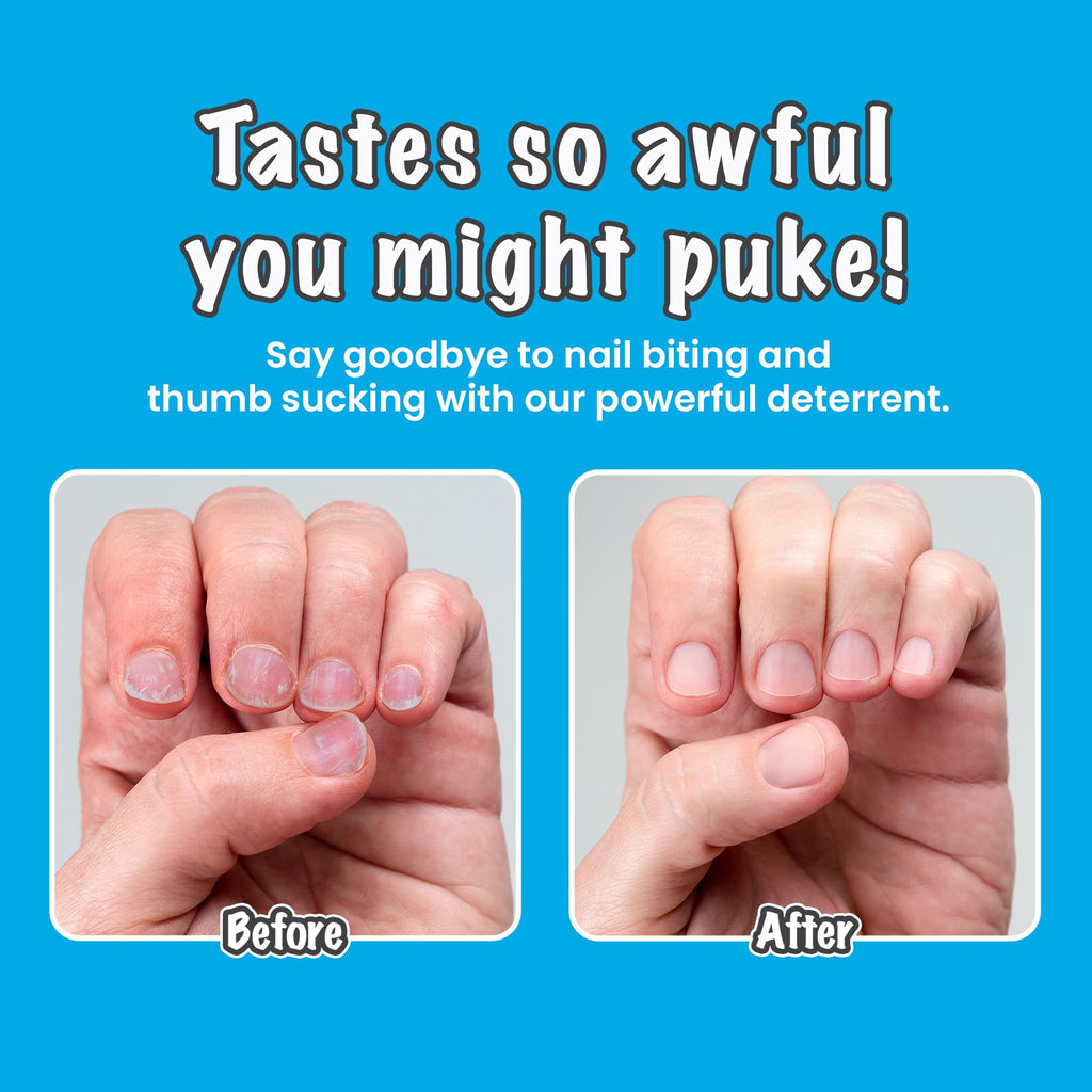 Biter Be Goner Nail Deterrent, Treatment for Kids and Adults, Non-Glossy Invisible Coating, Stop Nail Biting and Thumb Sucking Today, 0.3 Fl Oz