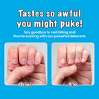 Biter Be Goner Nail Deterrent, Treatment for Kids and Adults, Non-Glossy Invisible Coating, Stop Nail Biting and Thumb Sucking Today, 0.3 Fl Oz