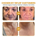 BeeRx Bee Venom Skin Treatment Cream, Professional Bee Venom Cream, BeeRx Anti Aging Serum, Repair,Reducing The Appearance of Blemishes, Natural Ingredients for All Skin Types (2 Bottle)