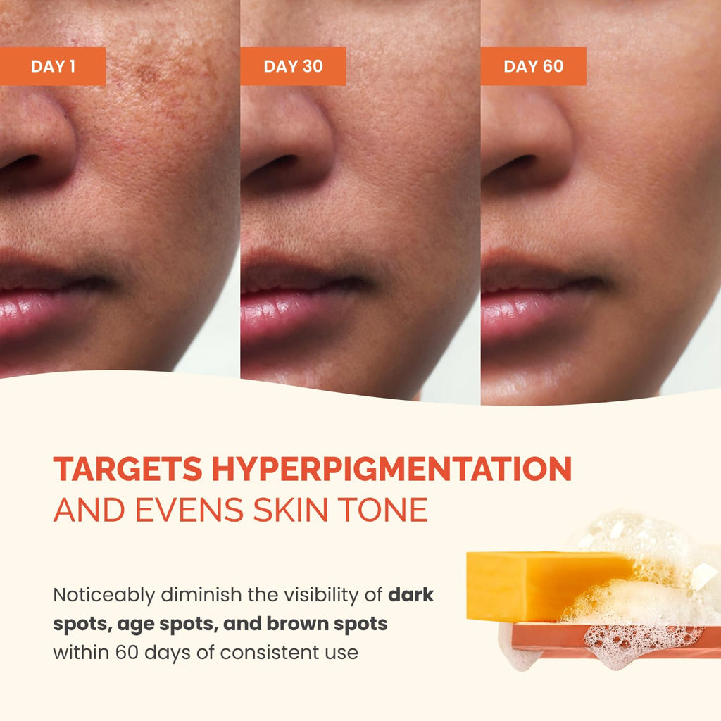 PLANTIFIQUE Kojic Acid Soap for Hyperpigmentation 4 Bars with Mesh Bag - Turmenic Soap with Hyaluronic Acid, Collagen, Vitamin C for Dark Spots - Vegan Skincare, 320g / 11.28 oz