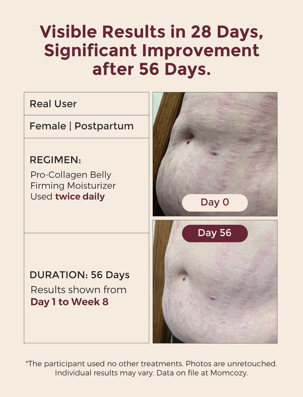 Momcozy Stretch Mark Cream for Pregnancy & Postpartum, Pro-Collagen Belly Firming Moisturizer, Facial-Grade Peptides & Oil-in-Cream, 5.29 oz (150g)