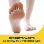 Dr. Scholl's Dual Action Freeze Away Wart Remover, 8 ct – Twice as Effective as Freezing Alone on Larger Warts, Fast-Acting Treatment for Common and Plantar Wart Removal, Safe to Use on Kids Ages 4+