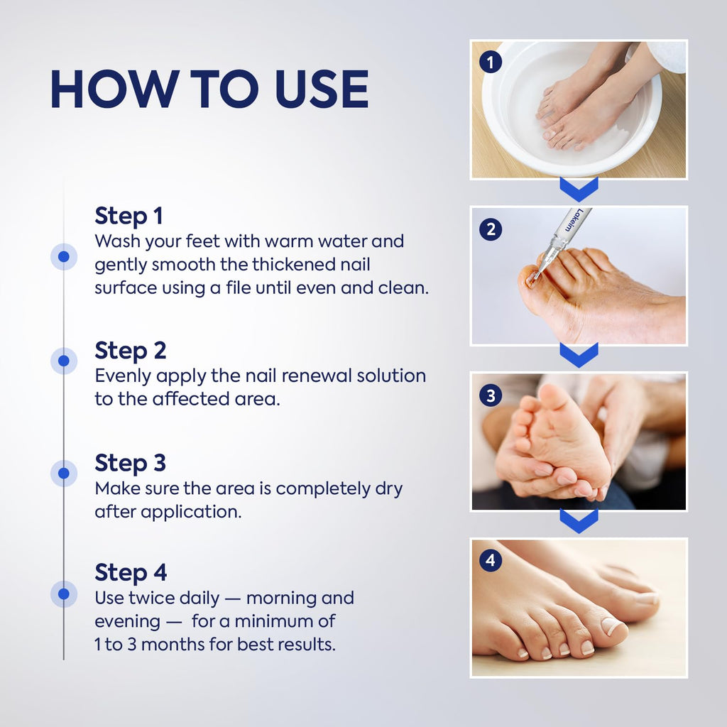 Toenail Fungus Treatment Extra Strength: 25% Undecylenic Acid & Tea Tree Oil - Repairs Yellow Thick Brittle Toe and Fingernails - 3 Pens with 5 Nail Files