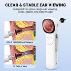 ScopeAround Digital Otoscope w/Built-in Screen, Manual-Focus Digital Otoscope with Light for Home Use, No App Needed, Easy Viewing for Everyday Ear Checks, Otoscope Camera, White
