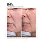 DRMTLGY Needle-less Serum - Anti-Aging Serum for Fine Lines & Wrinkles - Niacinamide with Potent Blend of Hyaluronic Acid, Peptides & Ceramides, 1 fl oz