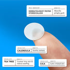 AVARELLE Pimple Patches for Face | Hydrocolloid Acne Patches for Covering Blemishes | FSA HSA Store Eligible Zit Patches with Tea Tree, Calendula, & Cica | (10-14 mm, 300 Count) Bulk Pack