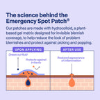 Curology Emergency Spot Pimple Patches for Face, Hydrocolloid Pimple Patches Fast-Acting, 80 Count