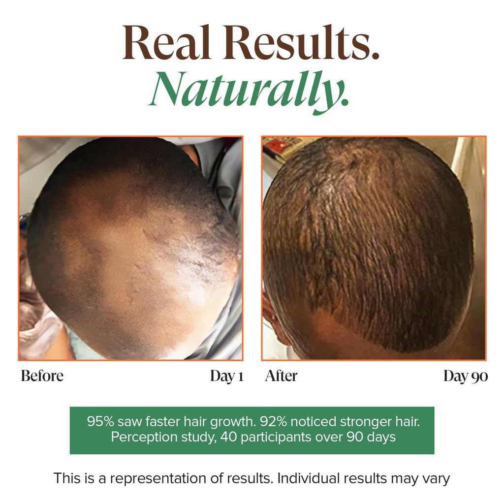 Kreyol Essence - Haitian Black Castor Oil for Skin and Hair, Glass Bottle - Cold Pressed Castor Oil, Fuller-Looking Hair, Hexane Free, Natural Humectant | 3.4 Fl Oz | Rosemary Peppermint