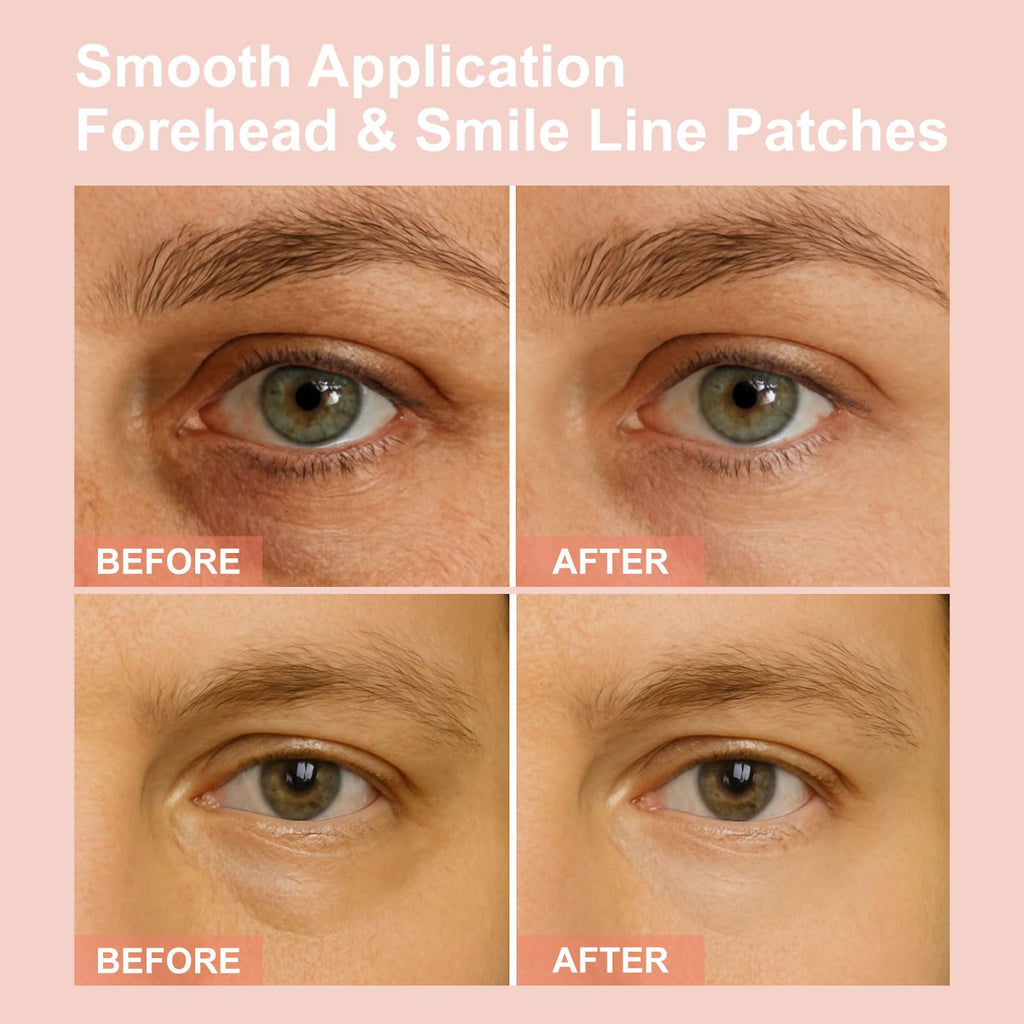 YLOTRE Novalift Micro Eye Patches, Under Eye Patches for Puffy Eyes, Dark Circles & Fine Lines, Deeply Hydrating Anti-Wrinkle Patches, Smooth Application Forehead & Smile Line Patches (2)