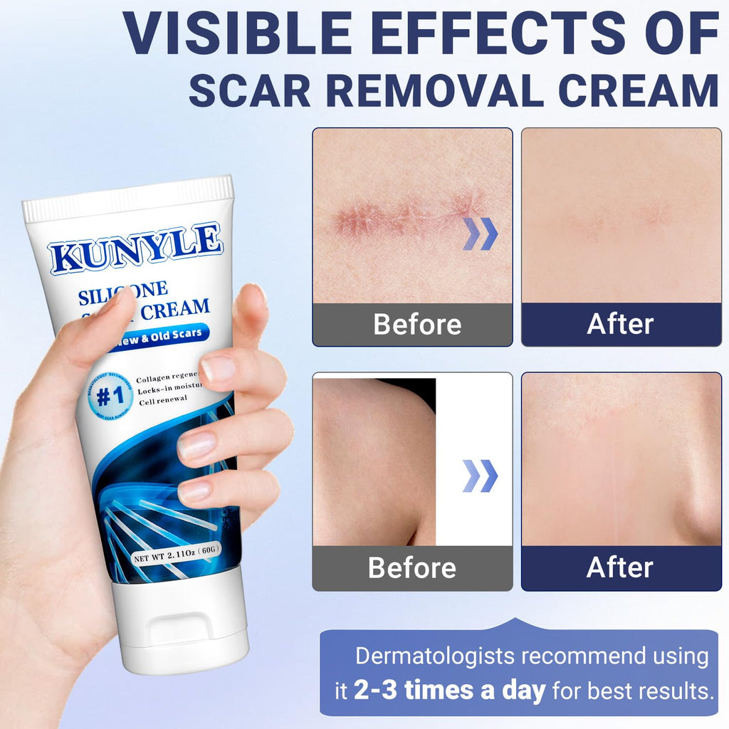 Kunyle Scar Cream, Silicone Scar Gel, Advanced Scar Removal Cream for Surgical Scars, Stretch Marks Removal, Keloid Bump Removal, Old and New Scars 2.11 Oz (60g)