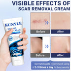 Kunyle Scar Cream, Silicone Scar Gel, Advanced Scar Removal Cream for Surgical Scars, Stretch Marks Removal, Keloid Bump Removal, Old and New Scars 2.11 Oz (60g)