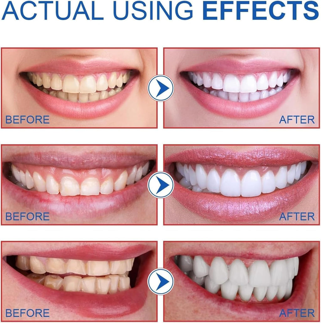 Sp6 Probiotic Ultra Whitening Toothpaste, Fresh Breath (2pcs)