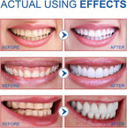 Sp6 Probiotic Ultra Whitening Toothpaste, Fresh Breath (2pcs)
