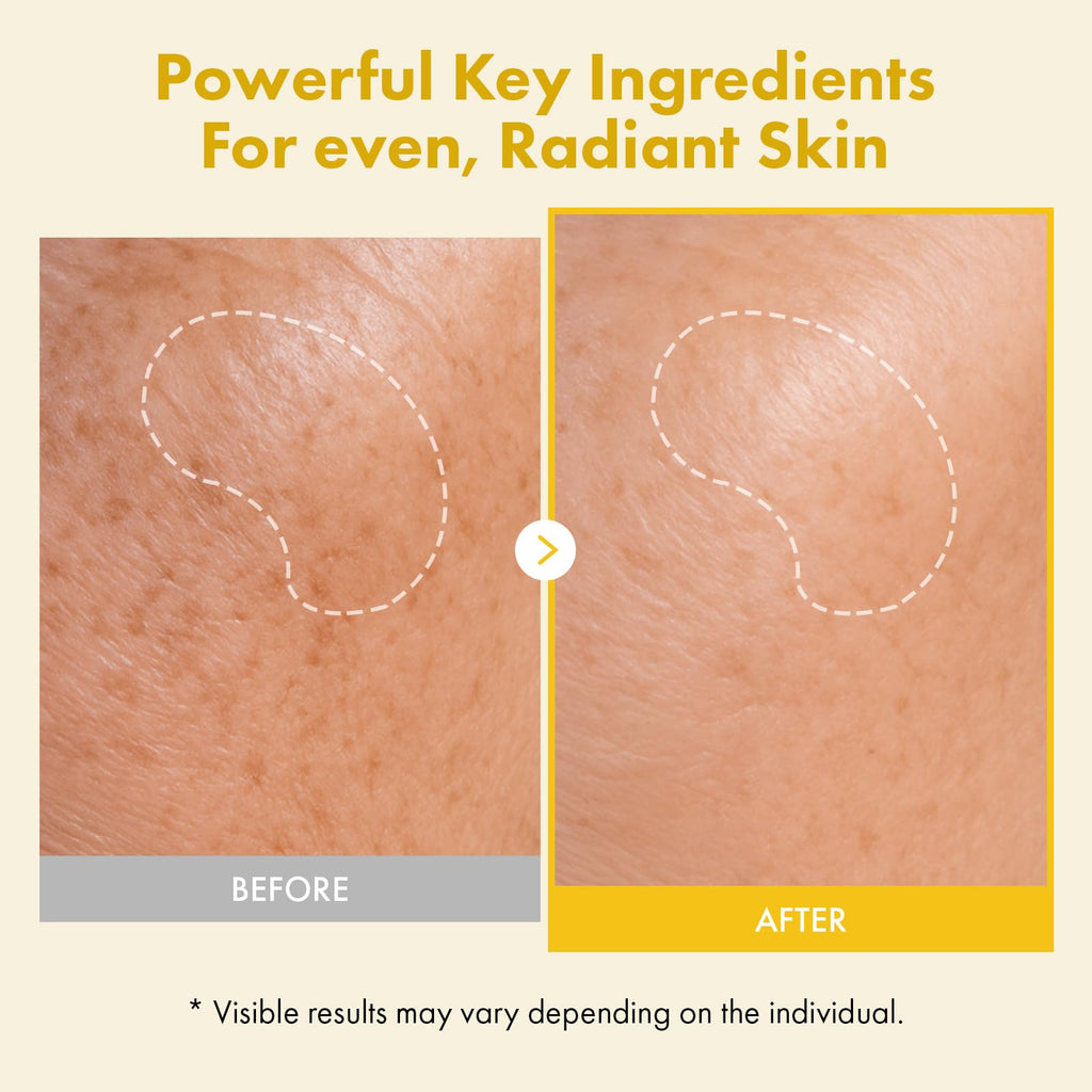 TOSOWOONG Real Kojic Acid Turmeric Fit, Dark Spot Wrapping Mask, Vitamin C & Glutathione Peel Off Facial Mask for Even Tone, Elasticity, Hydrating, Glow, Glass Skin, Korean Skincare, 50ml/1.69 fl. oz.