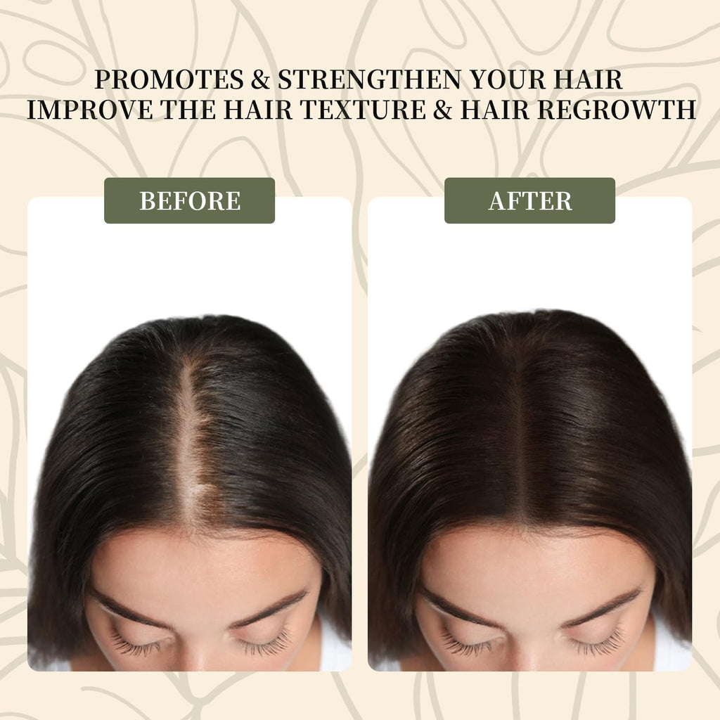 Vivccon Batana Oil for Hair Growth,100% Pure & Natural Raw Batana Oil, Dr. Sebi Organic from Honduras,Care for Hair Thickness,Scalp&Skin,4.23 fl oz,1 Bottle with 2 Caps