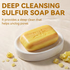 Bee & Flower Shanghai Sulfur Soap 10% Sulfur Soap Bar Face and Body Acne Treatment Sulphur Bar Soaps 3.4 Oz (6 Packs)