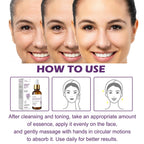 Venature Bakuchiol Retinol Rejuvenation Serum,2025 Best Retinol Serum for Wrinkles Bakuchiol Face Korean,