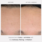 First Aid Beauty - 0.3% Retinol Complex Serum with Peptides, Designed for Sensitive Skin, Helps Visibly Improve Lines and Wrinkles with Less Irritation than Traditional Retinol, Non-Comedogenic, 1 oz
