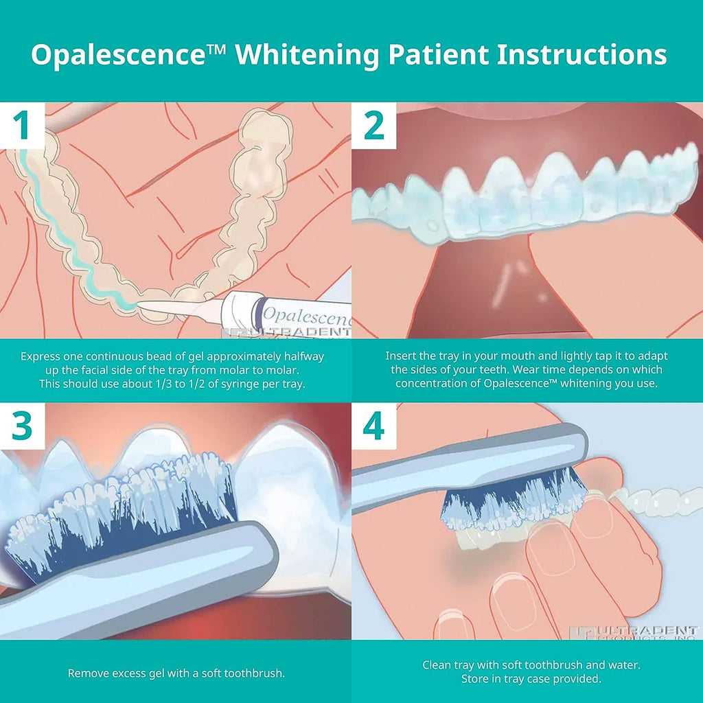 Opalescence 35% Gel Syringes Teeth Whitening - Refill Kit (8 Count) Carbamide Peroxide. Made by Ultradent, in Cool Mint Flavor. Tooth Whitening Refill Syringes 5197-4