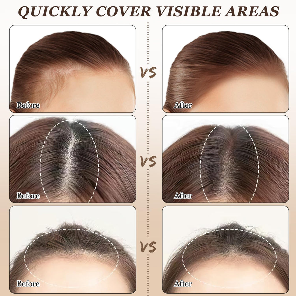 Nicgou Hairline Shadow Powder, Hair Shadow Root Cover Up, Hair Line Concealer Root Cover Up, Unisex Root Touch Up Hair Powder (Dark Brown, 01)