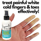Tamed Organics Raynaud's Symptom Relief Topical Treatment Cream Get Rid of Painful Cold White Stiff Fingers and Toes. Natural Vasodilator Formula Improves Circulation and Warms Hands and feet.