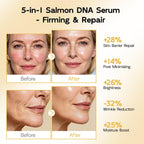 YouthVibe 0.5% PDRN Serum for Face, Anti-Aging Salmon DNA Face Serum with Hyaluronic Acid + Niacinamide + Squalane, Firming & Hydrating, Helps Smooth the Look of Fine Lines & Wrinkles, 30mL