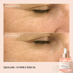 Biossance Rapid Radiance Set, Clean Skincare Gift for Glowing Skin, Valentine’s Day Beauty Gift for Her