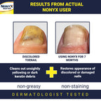 NONYX Fungal Nail Clarifying Gel | Clinically Proven for Discolored, Thick, Brittle, Yellow, Lifted, and other signs of Fungus-Damaged Toenails | 90% of Nails Improve | Over 8 million sold