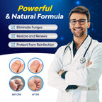 Toenail Fungus Treatment with 25% Undecylenic Acid, Toe Fungus Treatment for Toenail, Fungus Nail Treatment, Toenail Fungus Treatment Extra Strength, Fungal Nail Treatment for Athletes Foot - 2pcs