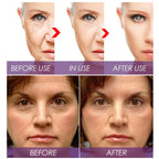 Venature Bakuchiol Retinol Rejuvenation Serum,2025 Best Retinol Serum for Wrinkles Bakuchiol Face Korean,