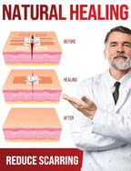 Emergency Wound Closure Strip - Laceration Closure Kit - Stitchless & Easy to Use - Butterfly Bandage
