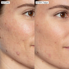Sunday Riley Sunday GGL-15-US-FG Riley Good Genes All-In-One Lactic Acid Treatment Face Serum 0.5oz