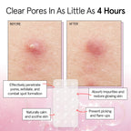 grace & stella Award Winning Pimple Patches for Face - Dermatologist Tested Acne Patches - Hydrocolloid Patch for Breakouts, Whiteheads - Vegan Acne Spot Treatment for Face (Invisible, 144 Count)