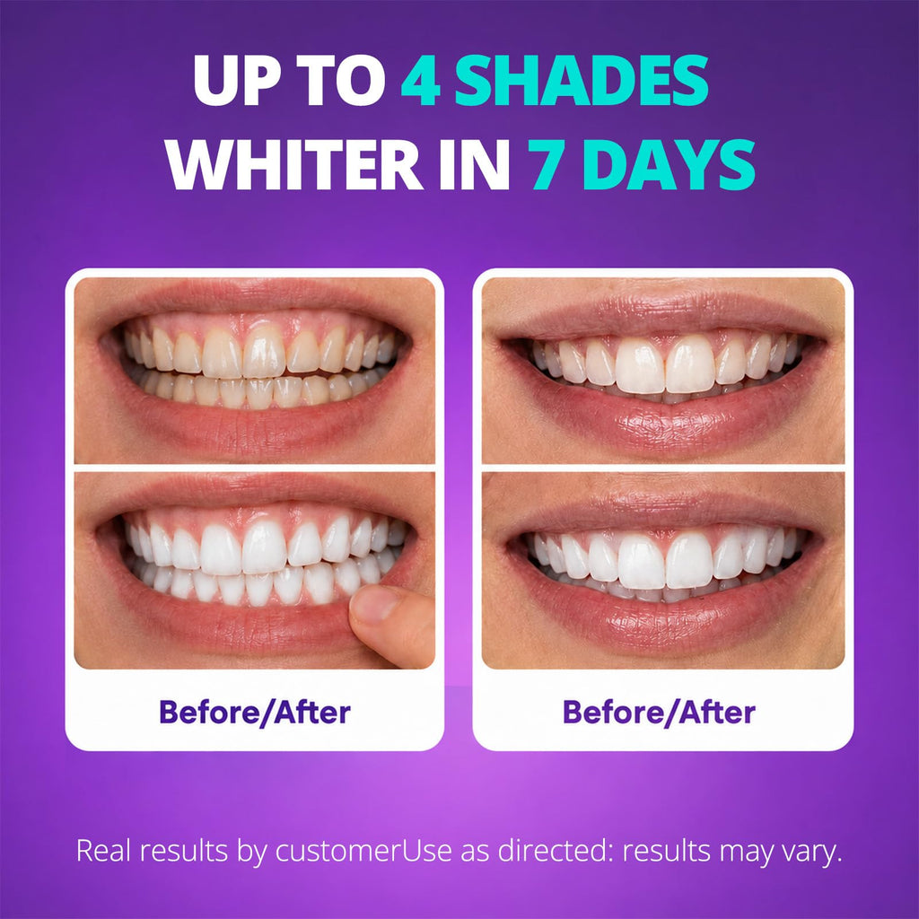 SAKYPRORAL Purple Whitening Strips, 90-Day Long-Lasting Results, Enamel Safe & Low-Sensitivity, Professional Teeth Whitening Strips with Non-Slip Dry Strip Technology (28 Count (Pack of 1))