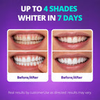 SAKYPRORAL Purple Whitening Strips, 90-Day Long-Lasting Results, Enamel Safe & Low-Sensitivity, Professional Teeth Whitening Strips with Non-Slip Dry Strip Technology (28 Count (Pack of 1))
