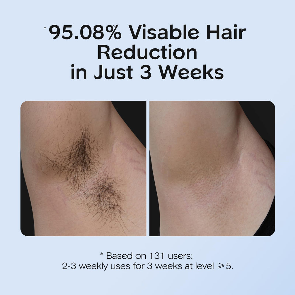INNZA IPL Hair Removal with Ice Cooling Care Function for Women and men