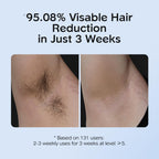 INNZA IPL Hair Removal with Ice Cooling Care Function for Women and men
