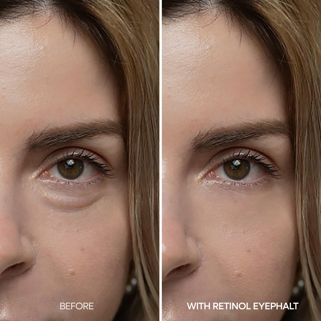 Dr.Melaxin Retinol Eyebag Cream for Puffiness, Dark Circles & Fine Lines, Wrinkle, EGF Anti-Aging Under Eye Moisturizer with Niacinamide&Ceramide Makeup friendly korean skin care