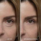 Dr.Melaxin Retinol Eyebag Cream for Puffiness, Dark Circles & Fine Lines, Wrinkle, EGF Anti-Aging Under Eye Moisturizer with Niacinamide&Ceramide Makeup friendly korean skin care