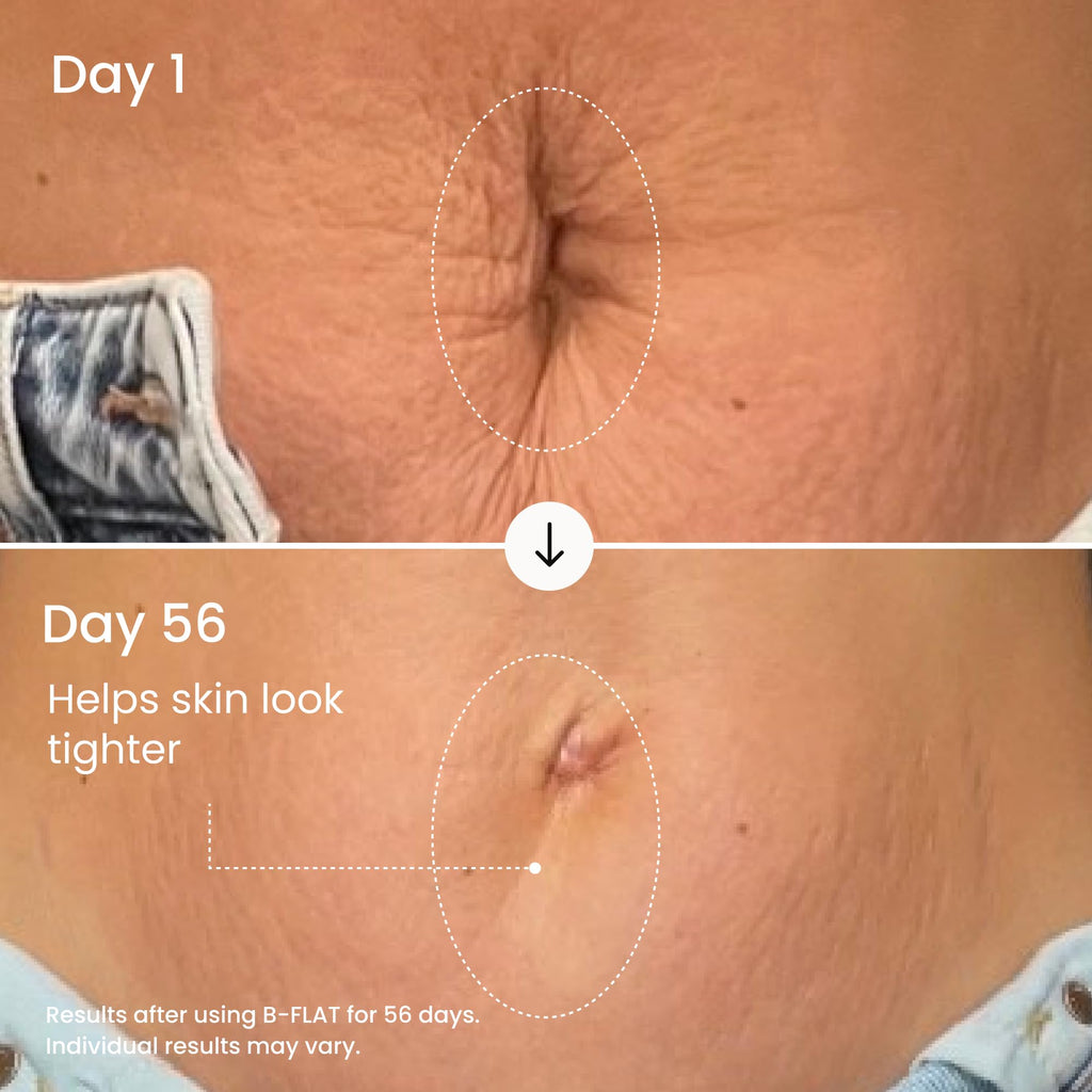 MAËLYS B-FLAT Belly Firming Cream for Women - Skin Tightening & Moisturizing Treatment with Shea Butter & Bentonite Clay - Smooths Look of Stretch Marks - Postpartum Body Care (3.4 Fl Oz)