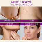 Cicatricure Cica Oil for Stretch Marks & Scars, Visible Results in 4 Weeks, Pregnancy Must-Haves Body Oil with Vitamin E, Stretch Mark Oil, Scar Treatment with Botanical Ingredients, 6.7 fl oz