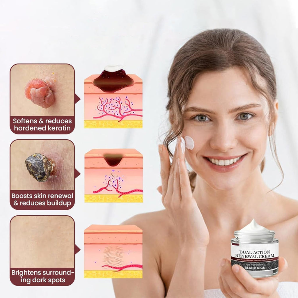 KeraErase Dual-Action Renewal Cream, Black and White Rice Soothing Repair cream, Professional Skin Treatment, Smooths And Refines The Skin, Natural Body Serum Suitable for All Skin Types (2PCS)