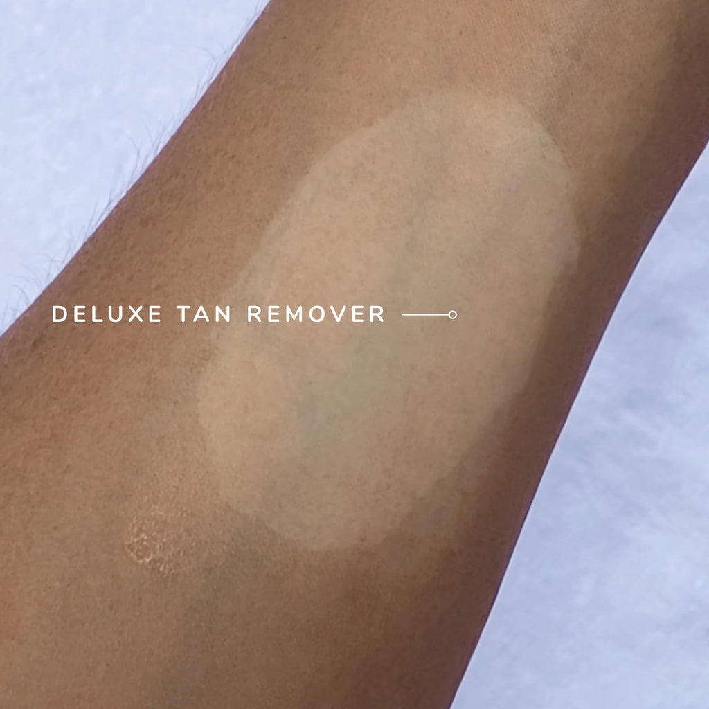 Loving Tan Deluxe Tan Remover Gel - Effective & Gentle Self Tanning Remover, Self Tanner Remover Suited for All Skin Types - Cruelty Free, Sulphate, Paraben & PEG Free - 6.7 Fl Oz