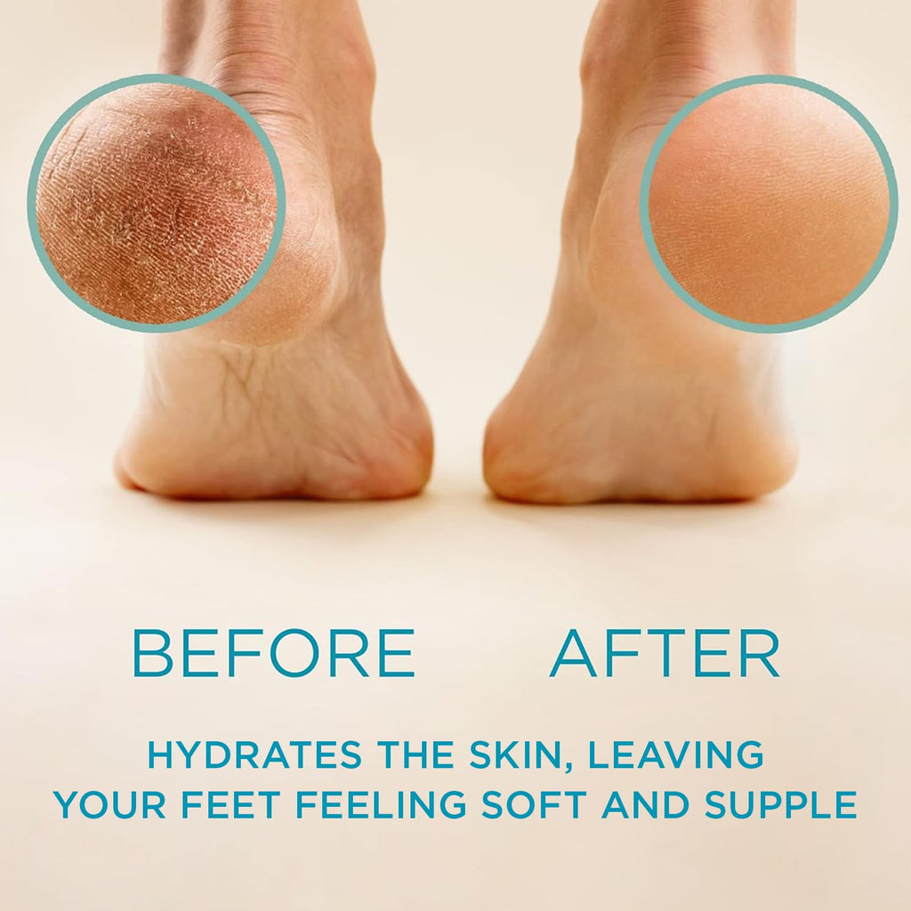 Lee Beauty 8oz Professional Gel Callus Remover for Feet - Original Fast-Acting Formula and Rasp Foot File Kit, Extra Strength for Cracked Heels & Dead Skin (Pack of 1)